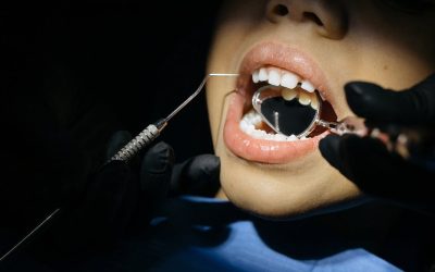 What Fixes Can Cosmetic Dentistry Offer for Chipped Teeth?